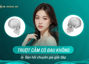 Trượt cằm có đau không? Bạn hỏi - Chuyên gia giải đáp