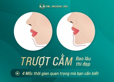 Trượt cằm bao lâu thì đẹp? 4 Mốc thời gian quan trọng mà bạn cần biết 