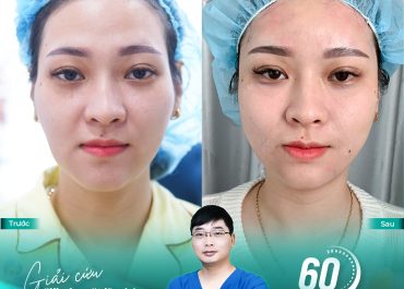 Chị em thức khuya - Công việc bộn bề: Kẻ thù số 1 của gương mặt tươi trẻ.