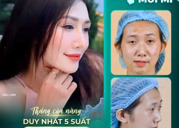 NHAN SẮC NHƯ Ý VỚI COMBO MŨI MÍ TẠI DR. HOÀNG HÀ 