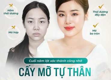 CUỐI NĂM LỘT XÁC THÀNH CÔNG NHỜ CẤY MỠ TỰ THÂN 