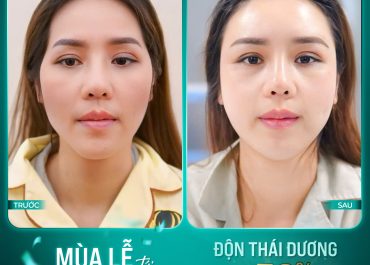 MÙA LỄ TỚI - TÂN TRANG DIỆN MẠO MỚI