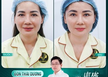 LỘT XÁC NGOẠN MỤC - TRẺ RA 10 TUỔI NHỜ ĐỘN THÁI DƯƠNG 