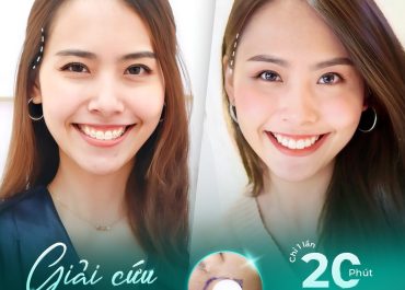  Khám phá độn thái dương – mảnh ghép cuối giúp bạn đẹp trọn vẹn!