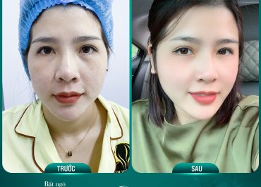 BIẾN HÓA NGOẠN MỤC CHỈ SAU 20 PHÚT – LÃO HÓA NGƯỢC 10 TUỔI!