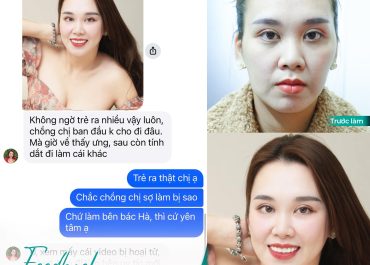 FEEDBACK SIÊU XỊN TỪ CHỊ THU CÚC SAU KHI CẤY MỠ TỰ THÂN 