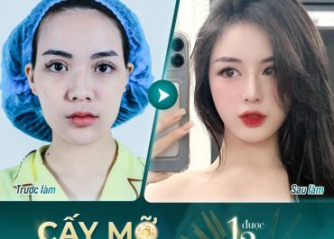  BIẾN HÓA DIỆU KỲ VỚI CẤY MỠ TỰ THÂN – LÀM 1 ĐƯỢC 2! 