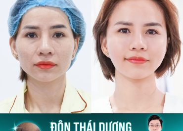 BẤT NGỜ VỚI NHAN SẮC 