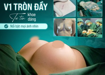 V1 TRÒN ĐẦY – TỰ TIN KHOE DÁNG – NỔI BẬT MỌI ÁNH NHÌN